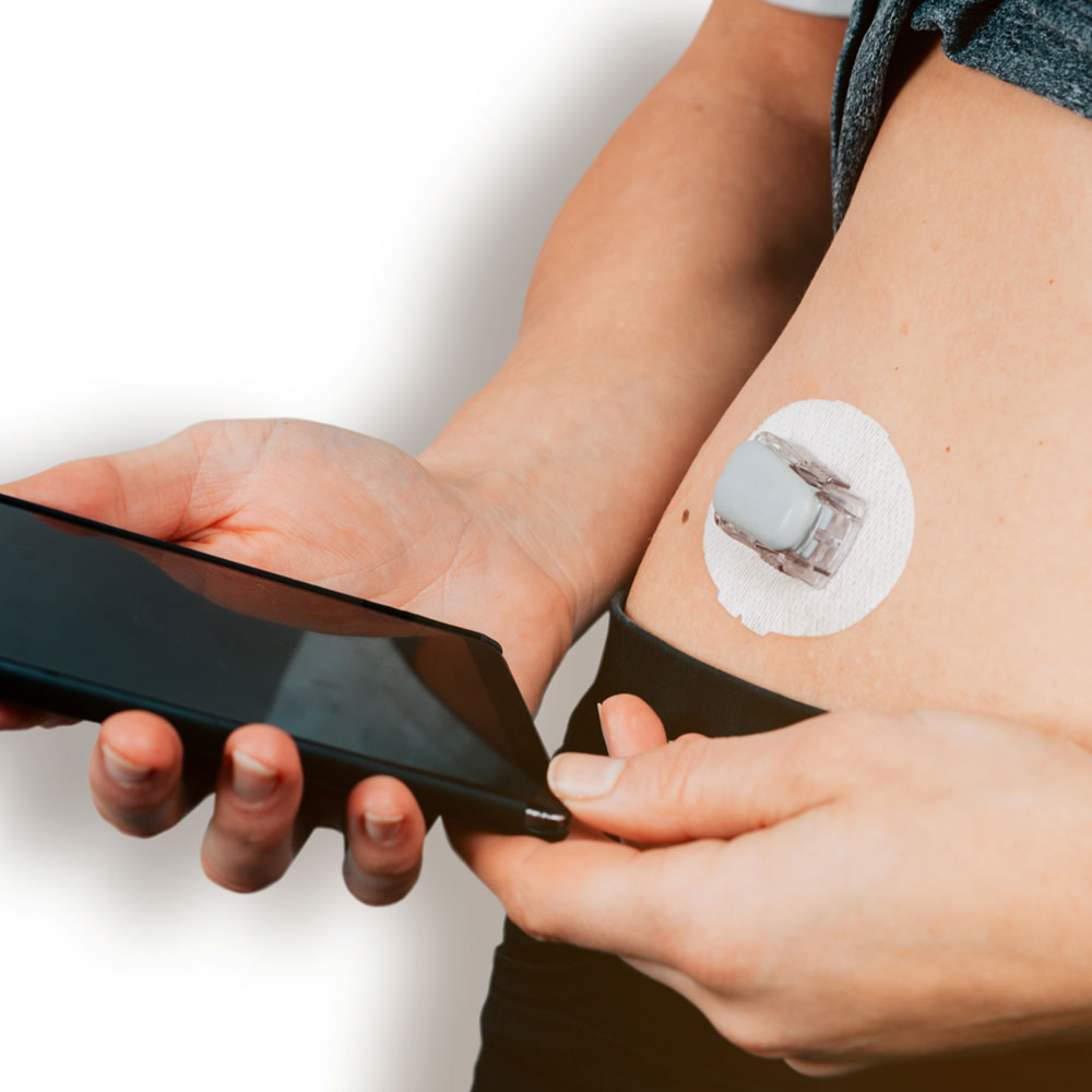 Insulinpumpe mit einer rtCGM-Option