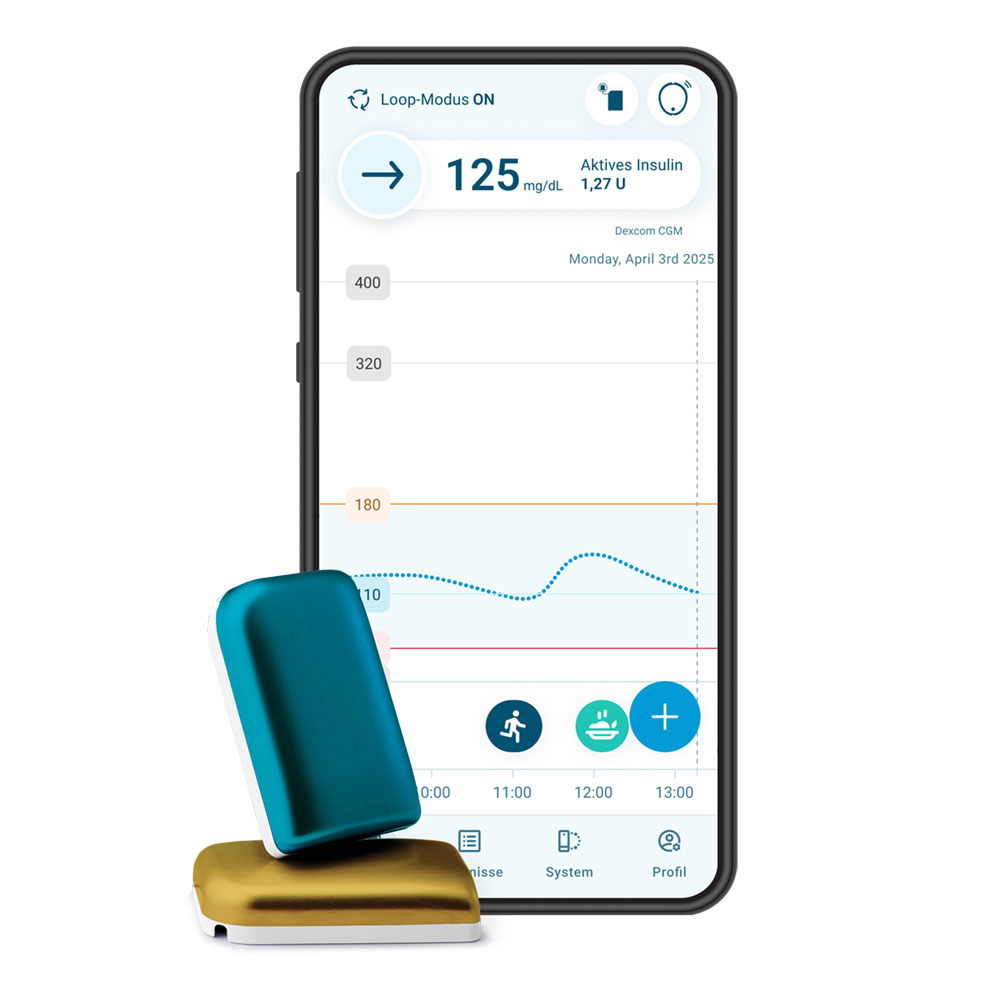 Kaleido mit dem DBLG2 Algorithmus und Dexcom G7