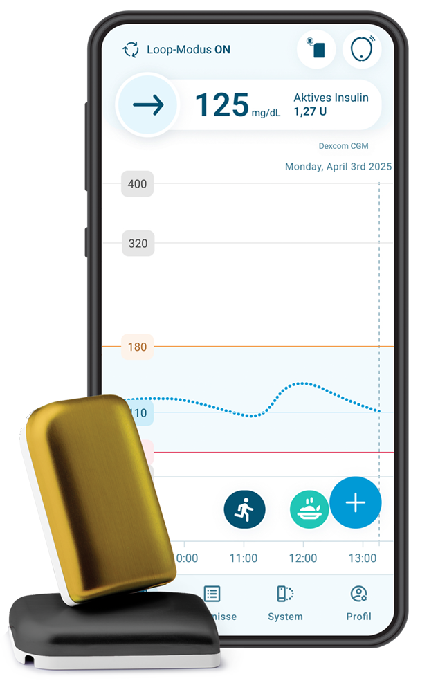 Kaleido mit dem DBLG2 Algorithmus und Dexcom G7
