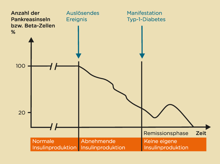 Die Phase der Entwicklung von Typ-1-Diabetes Die Phase der Entwicklung von Typ-1-Diabetes
