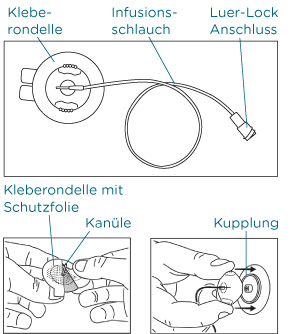Bestandteile eines Infussionssets
