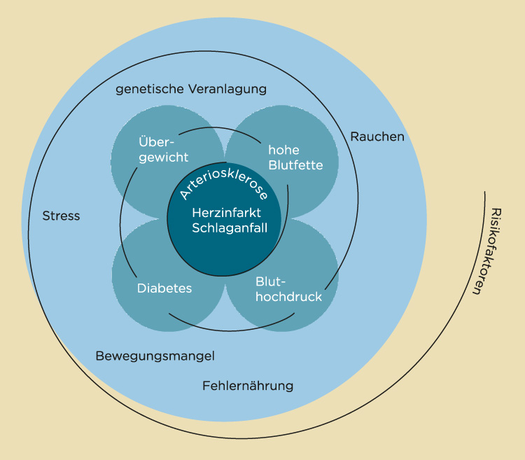 Metabolisches Syndrom und Diabetes Metabolisches Syndrom und Diabetes