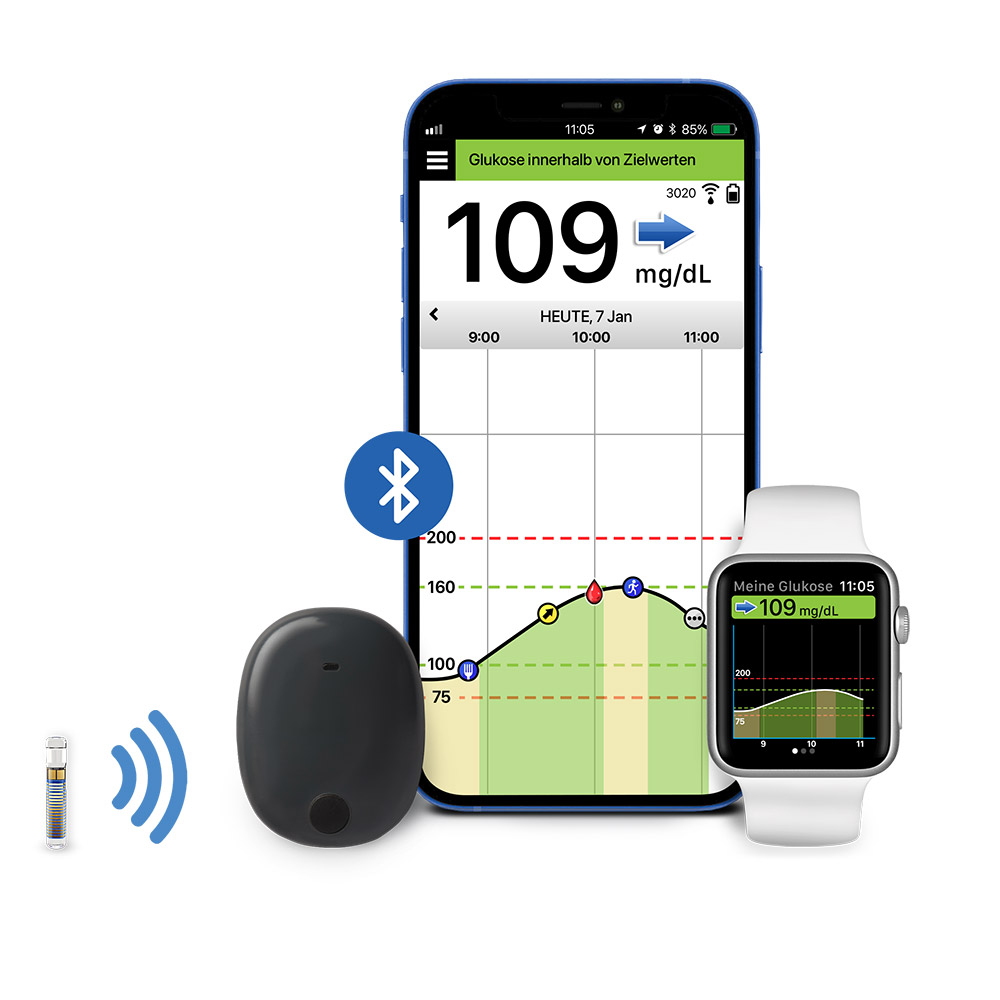 Eversense E3 rtCGM-System