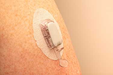 CGM-Systeme und Zubehör